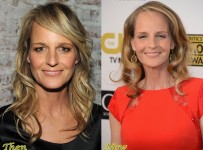 Helen Hunt Plastic Surgery Before And After Photos
