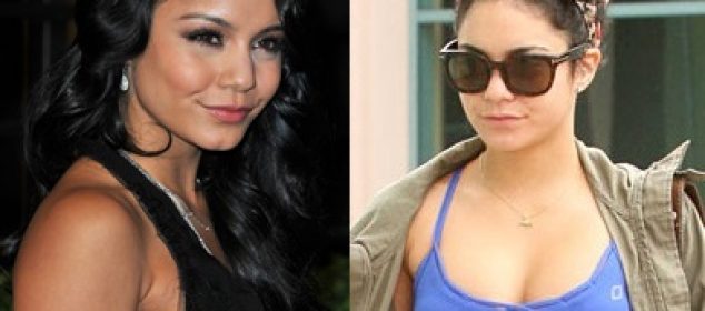 Vanessa Hudgens Plastic Surgery Before And After Breasts Implants Photos